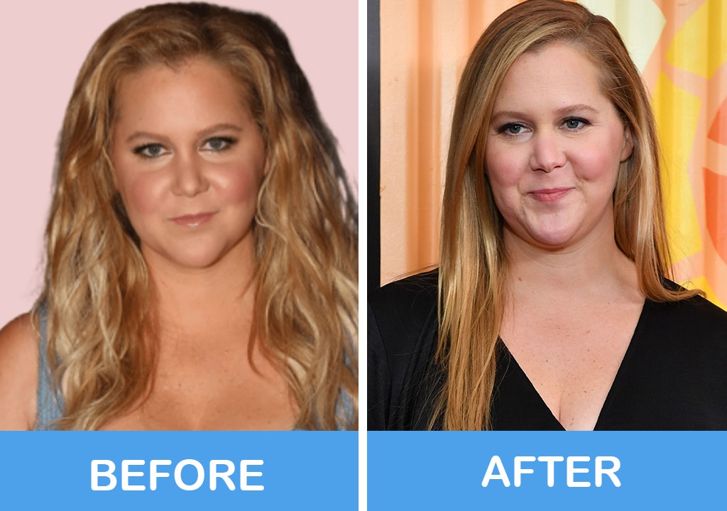 Amy Schumer