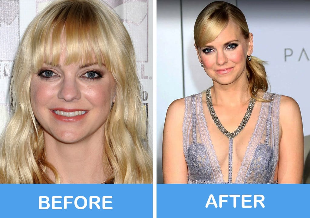 Anna Faris