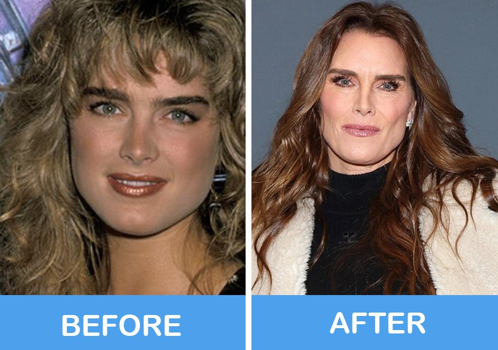 Brooke Shields