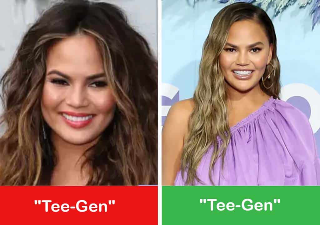 Chrissy Teigen