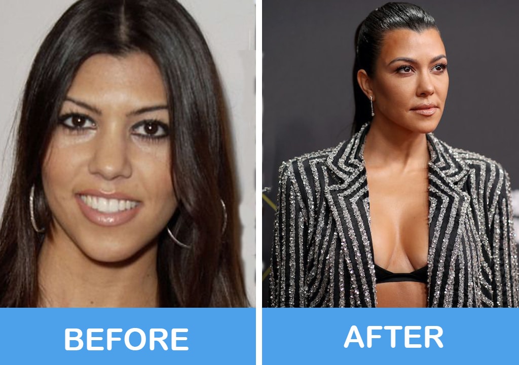 Kourtney Kardashian