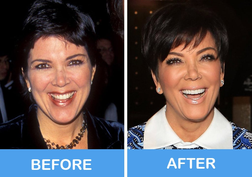 Kris Jenner