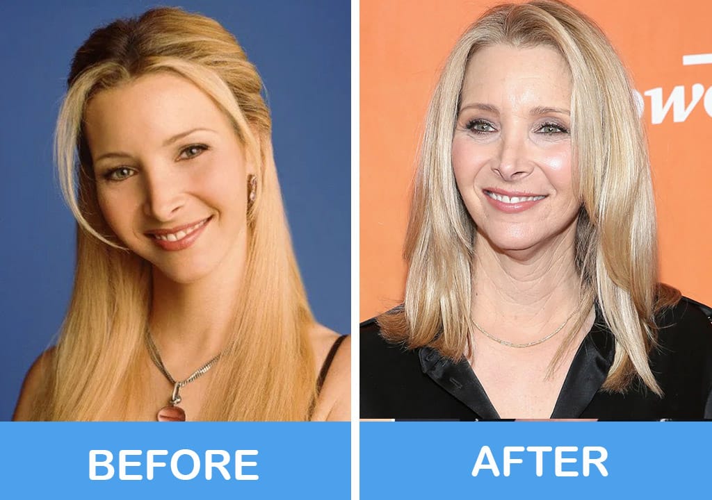 Lisa Kudrow