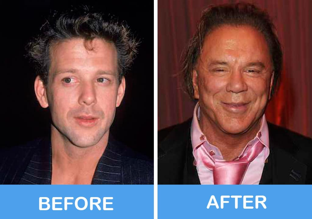 Mickey Rourke