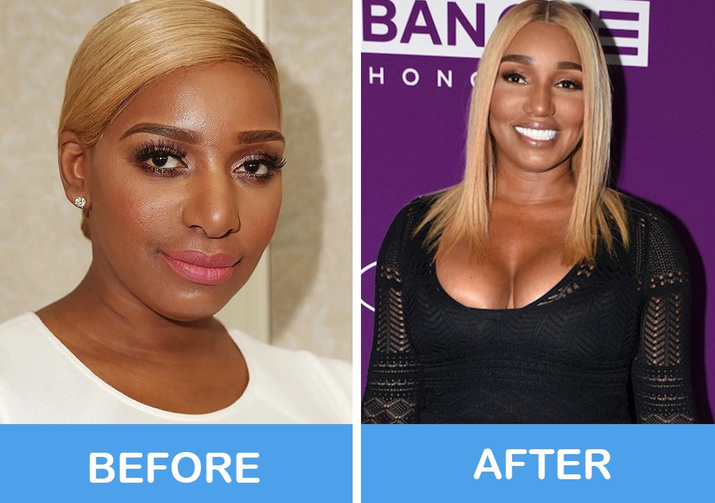 NeNe Leakes