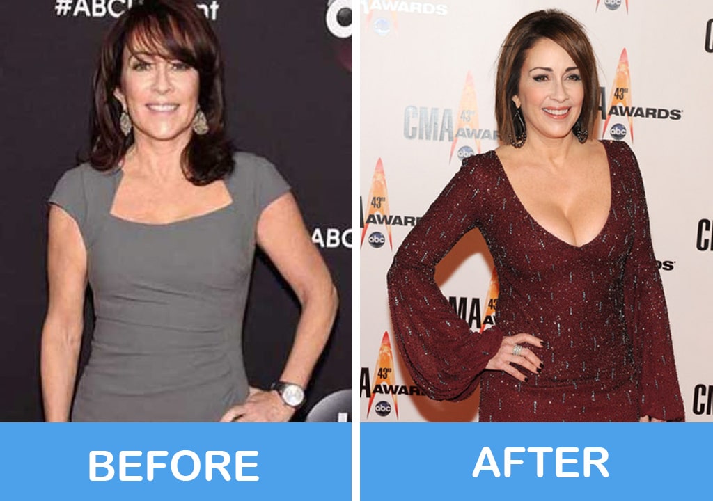 Patricia Heaton